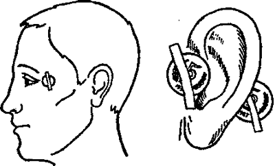 Металл, несущий выздоровление