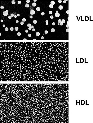 Три главных типа липопротеиновых частиц с холестерином, циркулирующие в крови